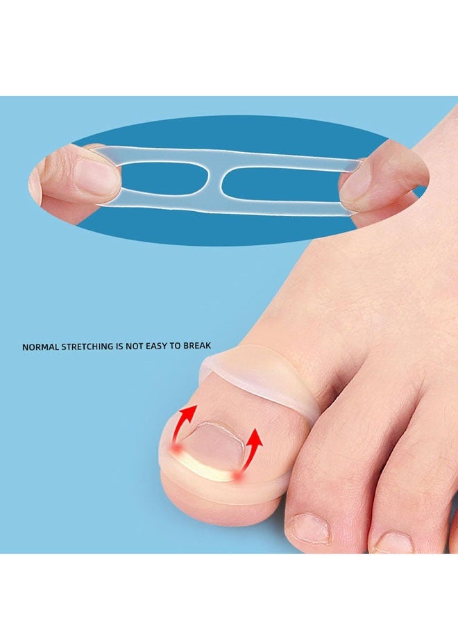 ١٠ قطع من حلقات تصحيح الأظافر الناشبة، حلقات سيليكون لتصحيح الأظافر الناشبة - مقاومة للتمدد، قابلة لإعادة الاستخدام - Image 4